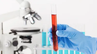 zdjęcie do artykułu: Pakiet badań - anemia